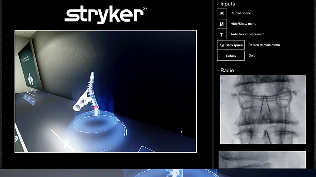 Écran de la simulation Stryker : colonne vertébrale en 3D et radio peropératoire