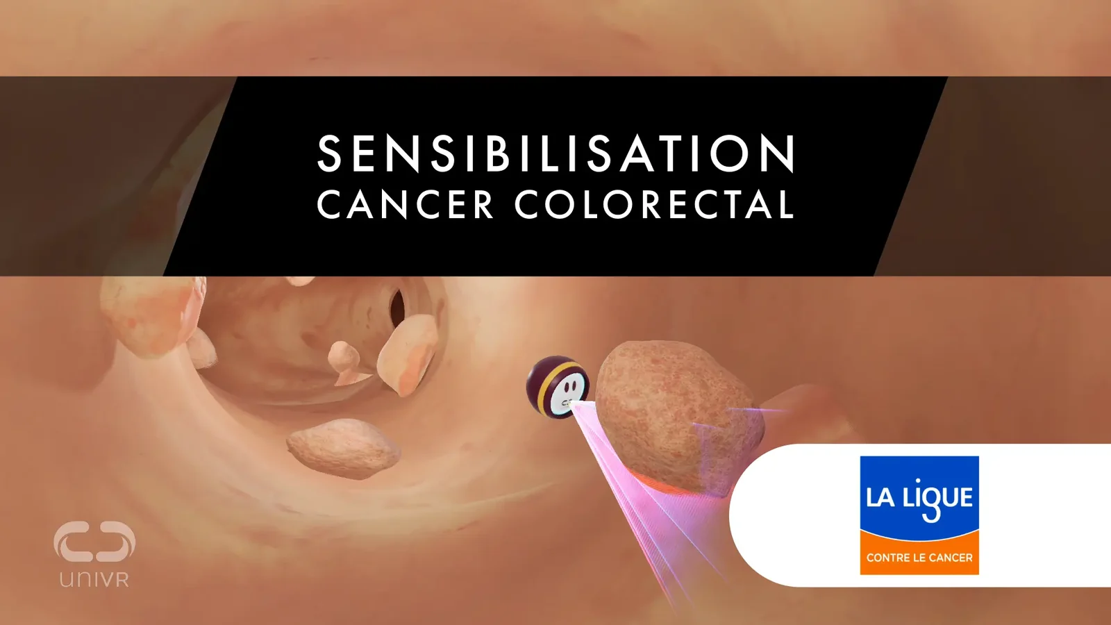 Sensibilisation cancer en réalité virtuelle