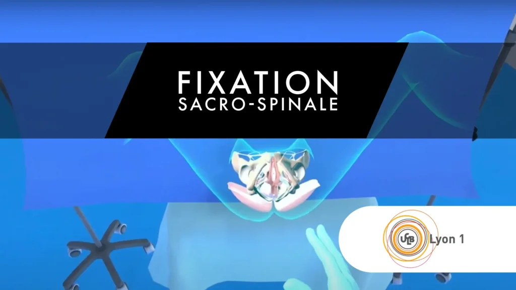Simulation en réalité virtuelle de la chirurgie de fixation sacro-spinale