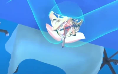chirurgie virtuelle simulateur