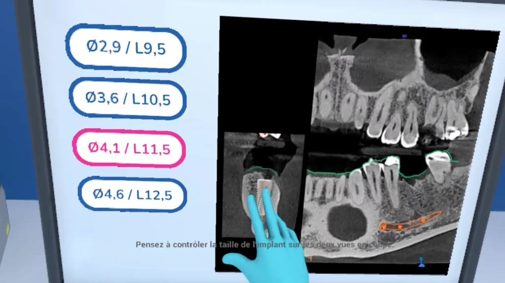 Formation en réalité virtuelle - implantologie dentaire