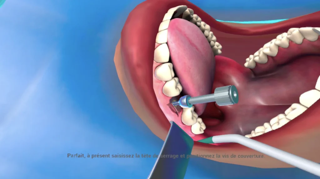 Formation en réalité virtuelle - Zedental - dentaire -2025-01-27 à 154229